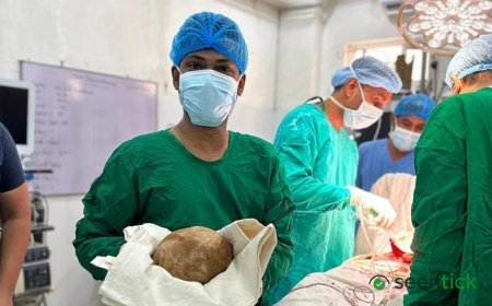 Doctors remove 3.1kg stone from man's bladder and claim record