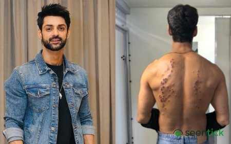 Karan Wahi recalls the impact of controversial pellet gun task on Khatron Ke Khiladi 15: ‘My mind went numb’
