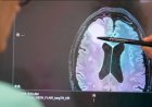 How a rapid new test is helping brain tumour patients
