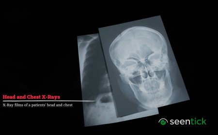 How to take the X-Rays in Silent Hill Townfall
