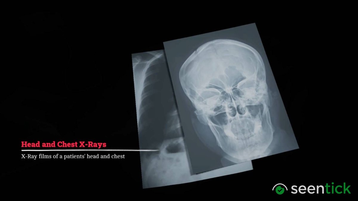 How to take the X-Rays in Silent Hill Townfall