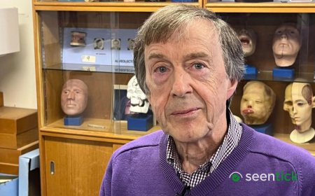 'I could never hear on my left side - until I got a prosthetic ear'