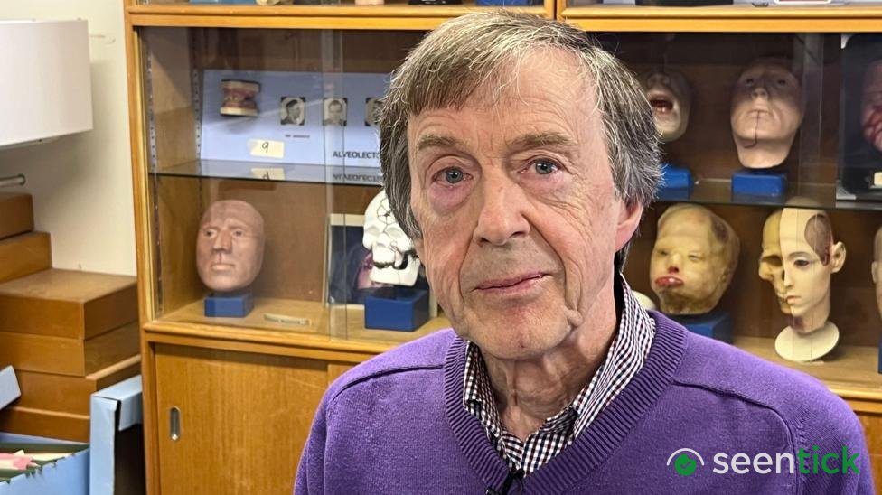Ulster Hospital's Prosthetic Breakthrough: 74-Year-Old Man Regains Hearing with New Ear