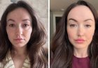 Lucy's Iron-Deficiency Struggle Sparks Social Media Debate