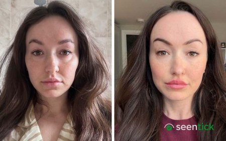 Lucy's Iron-Deficiency Struggle Sparks Social Media Debate