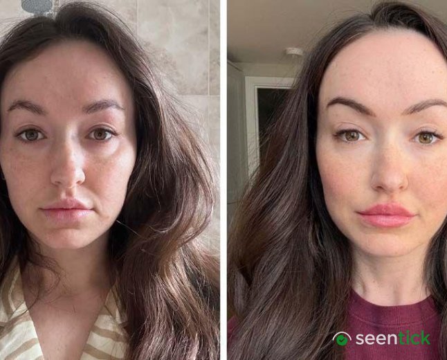 Lucy's Iron-Deficiency Struggle Sparks Social Media Debate