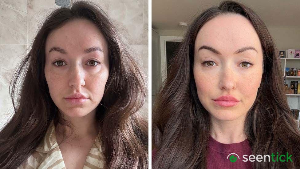Lucy's Iron-Deficiency Struggle Sparks Social Media Debate