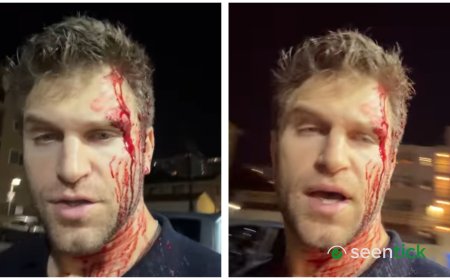 Pretty Little Liars star Keegan Allen robbed and beaten at gunpoint outside grocery store: 'West Hollywood is not safe anymore'