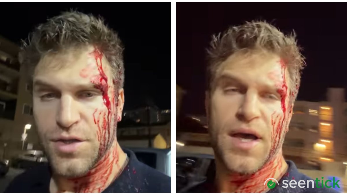 Pretty Little Liars star Keegan Allen robbed and beaten at gunpoint outside grocery store: 'West Hollywood is not safe anymore'