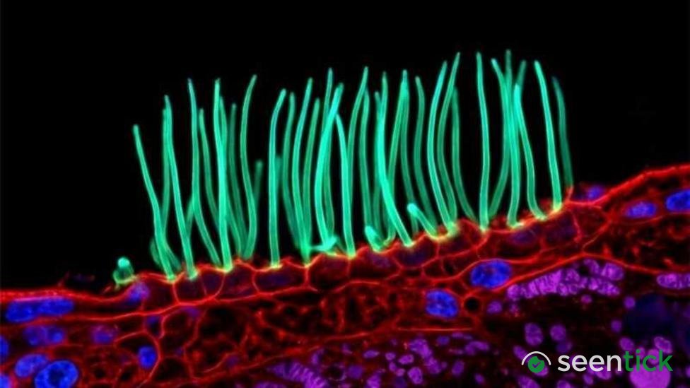 Tiny image sparks big backlash in Nikon photo contest