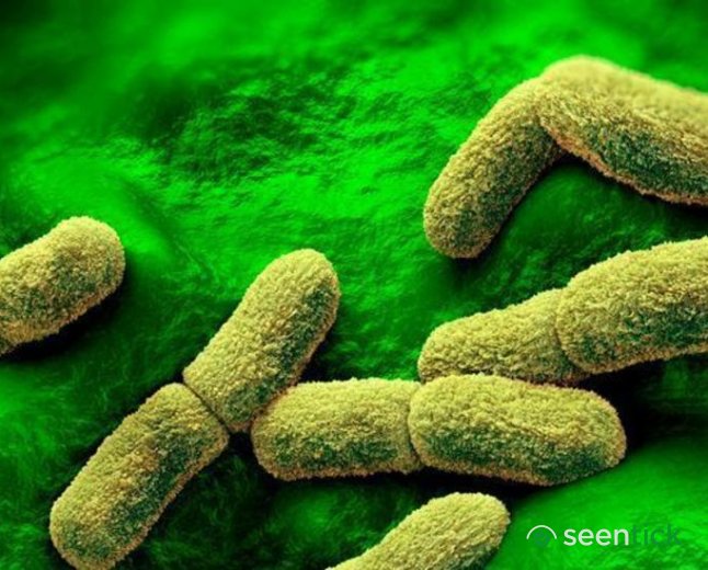 US 'watching closely' after plague researcher dies in Russia, Rubio says